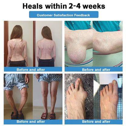 Official Store：👩‍⚕️Recommended by AAOS🏃‍♂️‍➡️AnnieCare® Nano-microneedle joint patch (Painless, long-lasting, suitable for arthritis, varicose veins and various orthopedic diseases)