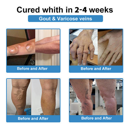Official Store：👩‍⚕️Recommended by AAOS🏃‍♂️‍➡️AnnieCare® Nano-microneedle joint patch (Painless, long-lasting, suitable for arthritis, varicose veins and various orthopedic diseases)