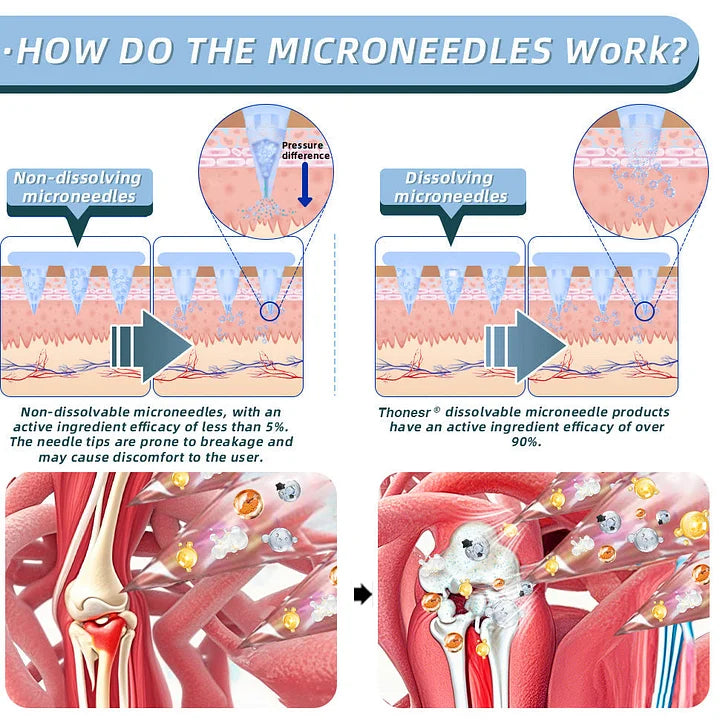 Official Store：👩‍⚕️Recommended by AAOS🏃‍♂️‍➡️AnnieCare® Nano-microneedle joint patch (Painless, long-lasting, suitable for arthritis, varicose veins and various orthopedic diseases)