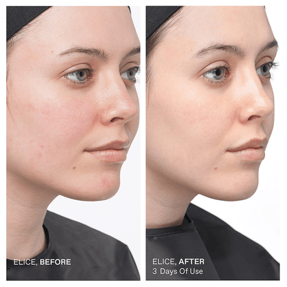 Gold & Aloe Combo Mud Mask