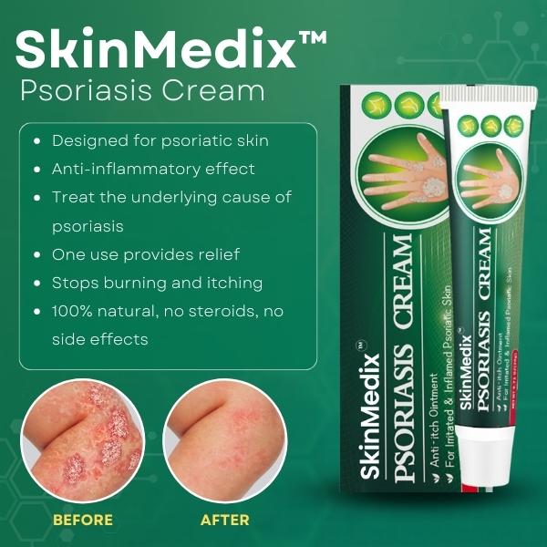SkinMedix™ Natural Herbaceous Plants Psoriasis Cream(Visible change in one week!)